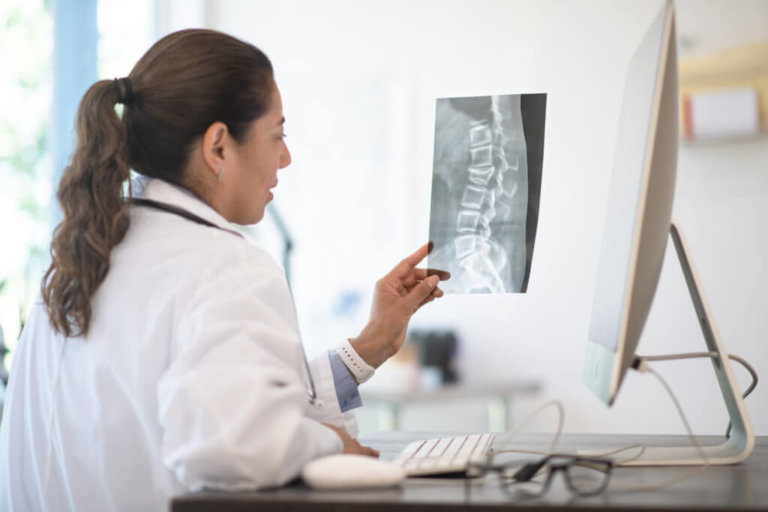 Female doctor at a desk reviewing an x-ray of the spine