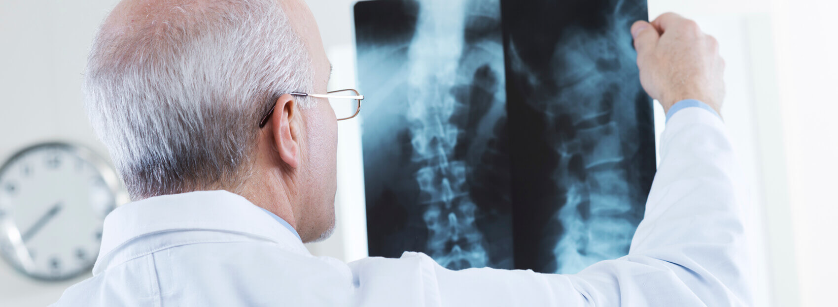 Doctor looking at a spine x-ray