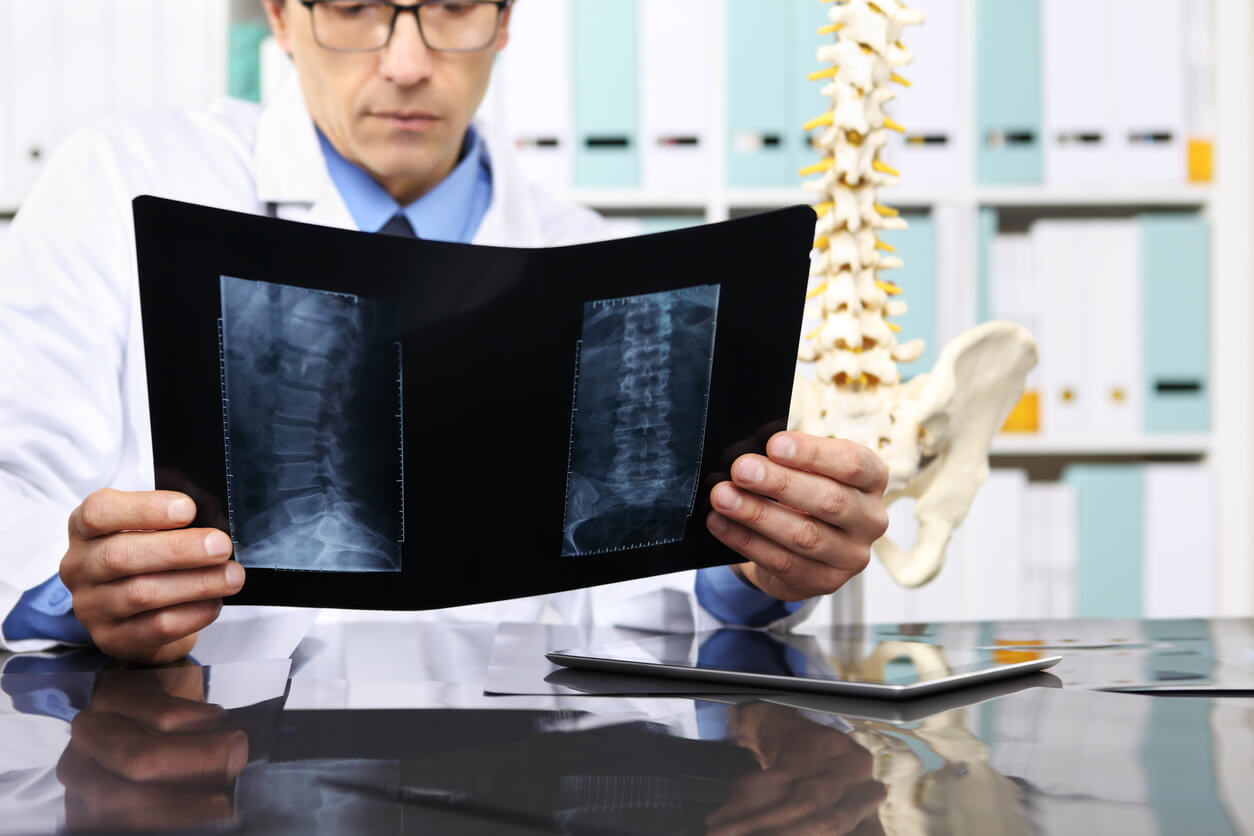 Doctor reviewing patients' x-rays of herniarted disc.