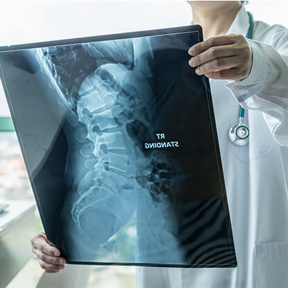 Doctor holding an x-ray of the lower spine and pelvis