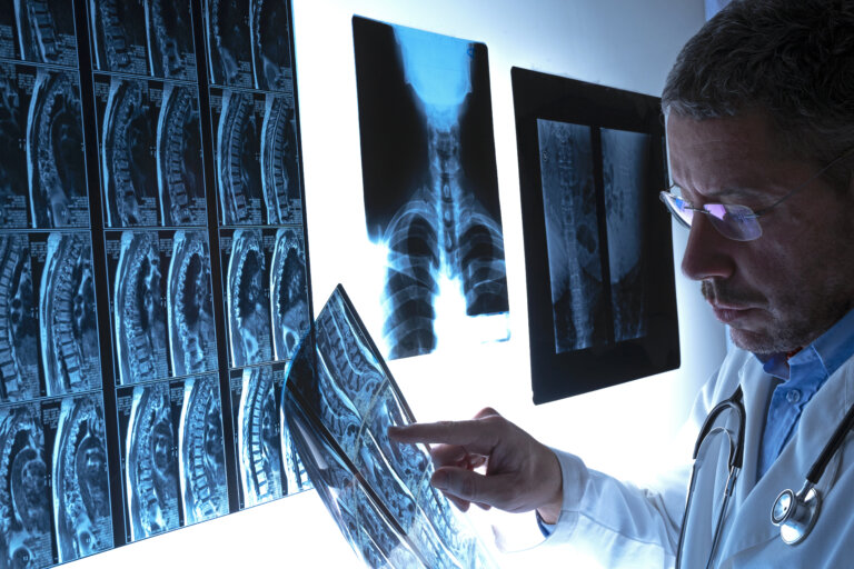 doctor reviewing imaging test