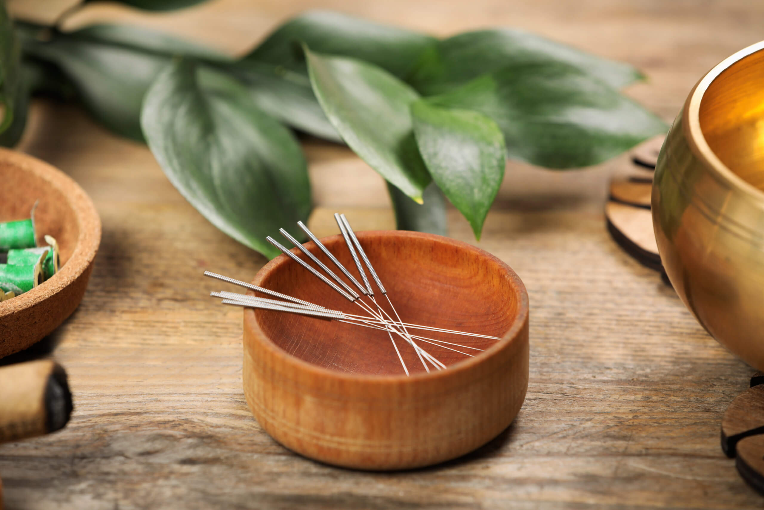acupuncture needles