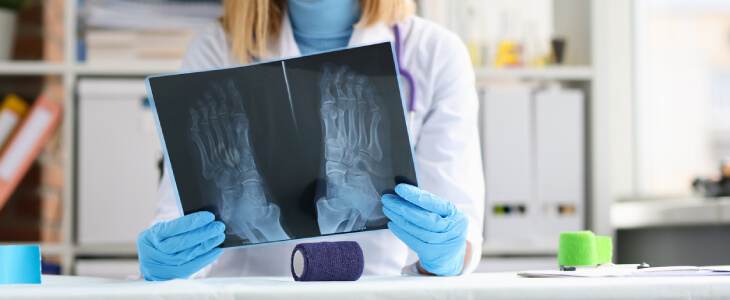 Doctor holding X-ray of feet