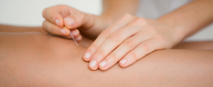 Acupuncture for knee pain