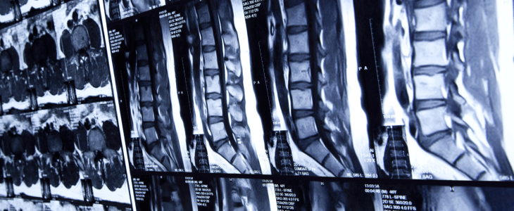 Scans of the spine