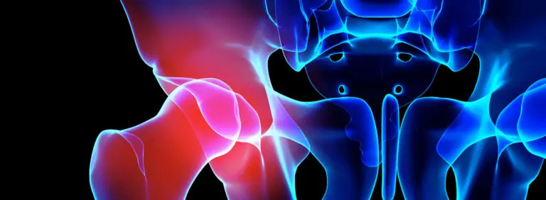 Digital graphic image of the hip bones
