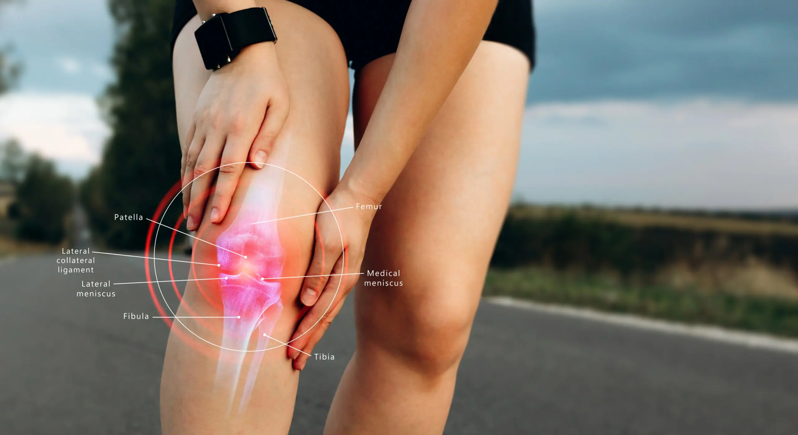 runner with torn acl