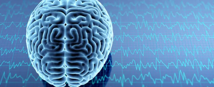 Digital graphic of a brain