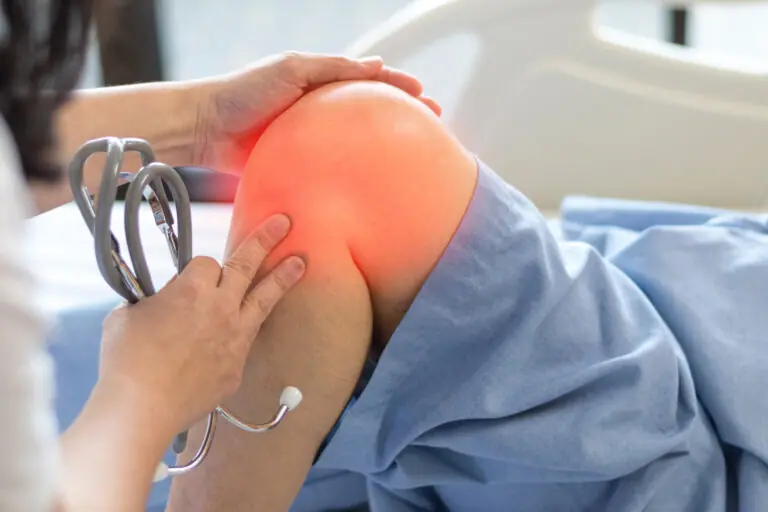 Doctor check up or exam patient knee bone and joint for patellofemoral infection